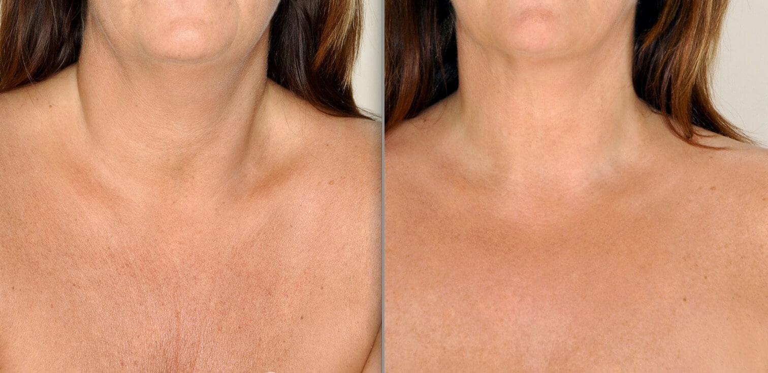 кожа на груди у женщин фото 29